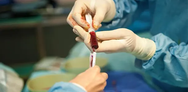 نکات قبل از ازمایش مغز استخوان